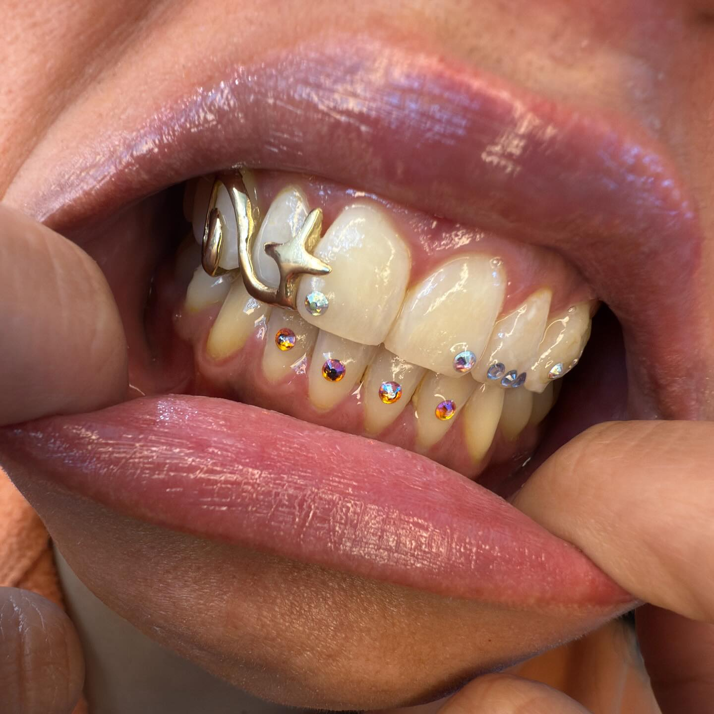 9K solid gold canine swirl and star cap filler grillz