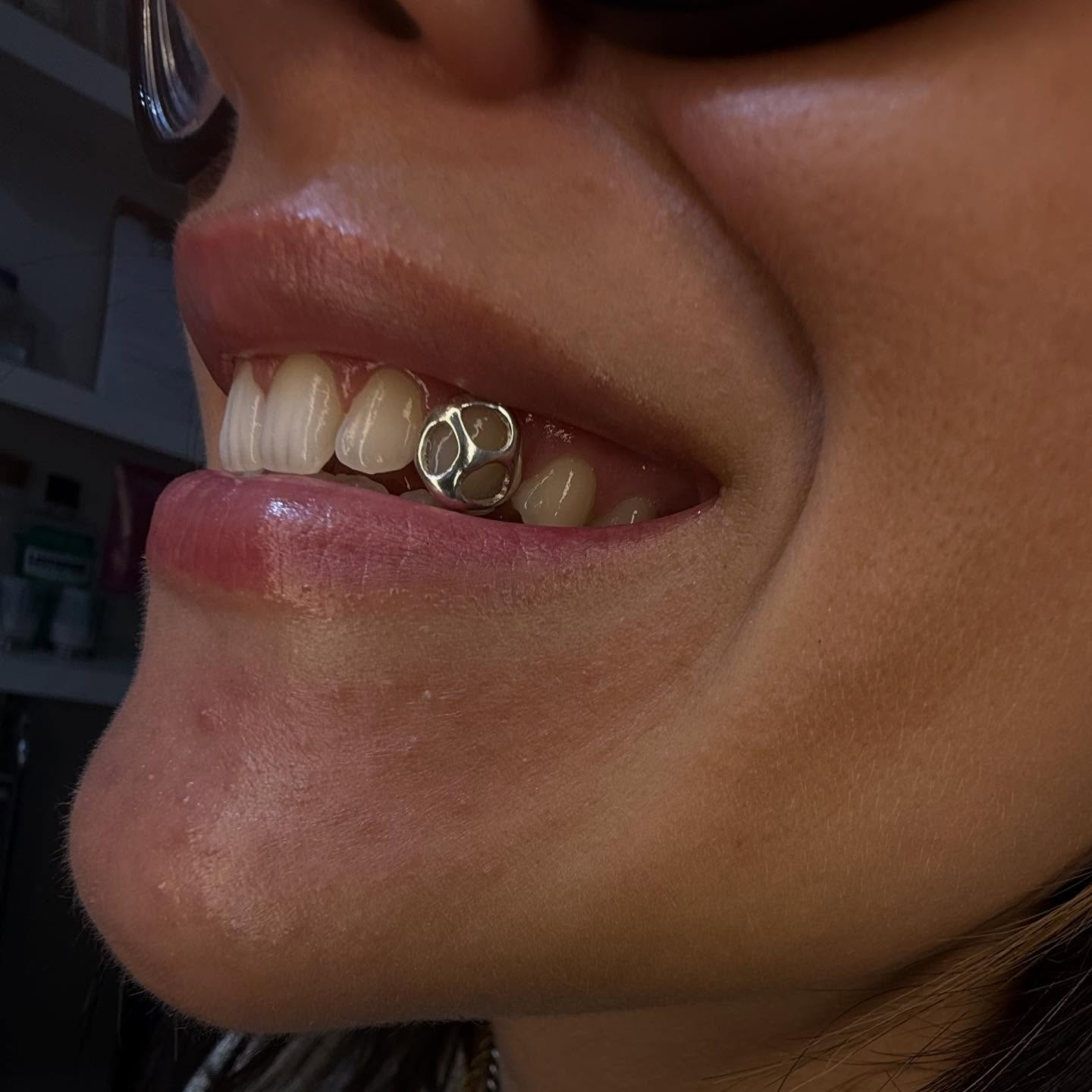 Sparkling crystal tooth gems close-up