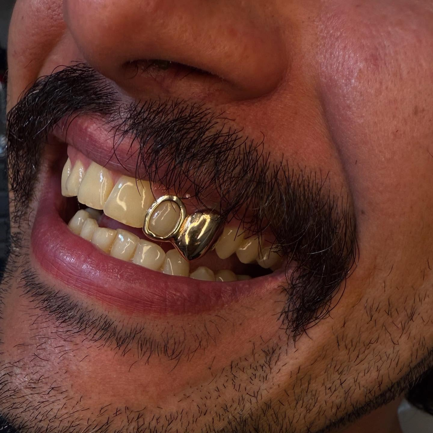 Client showing investment smile with custom tooth jewelry