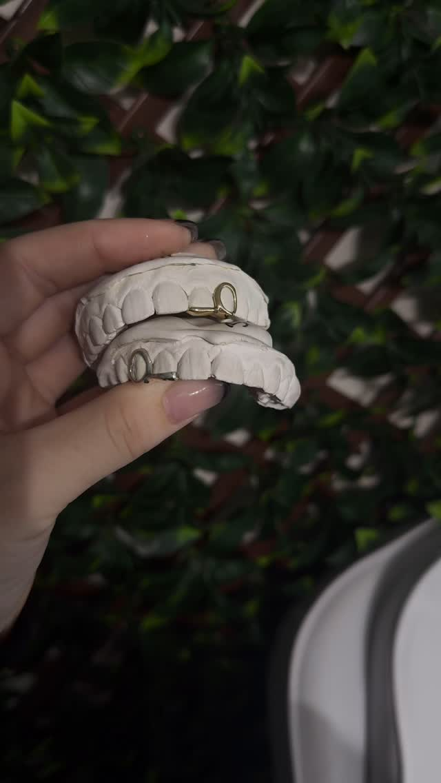 Custom grillz mold outdoors