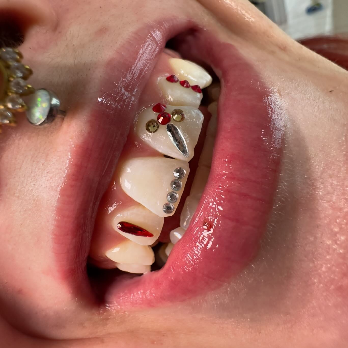 Client tooth gem styling inspiration close-up