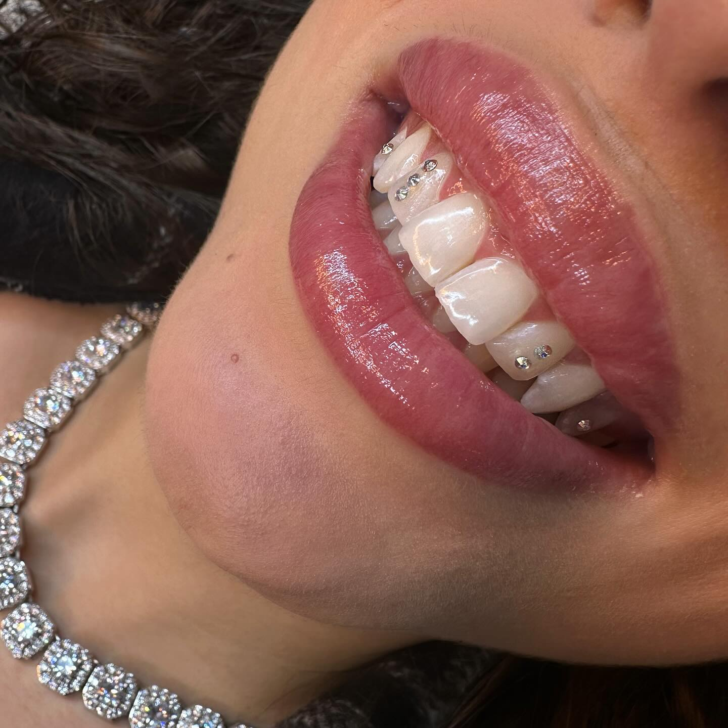 Solid gold canine swirl grillz custom set
