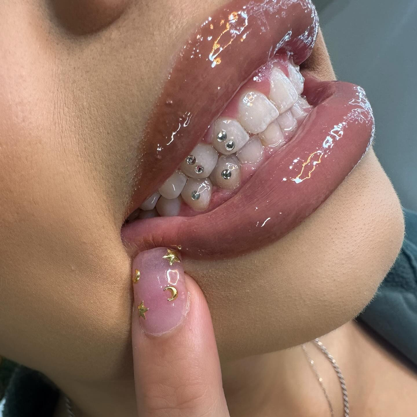 Client with tooth gems and glossy lip