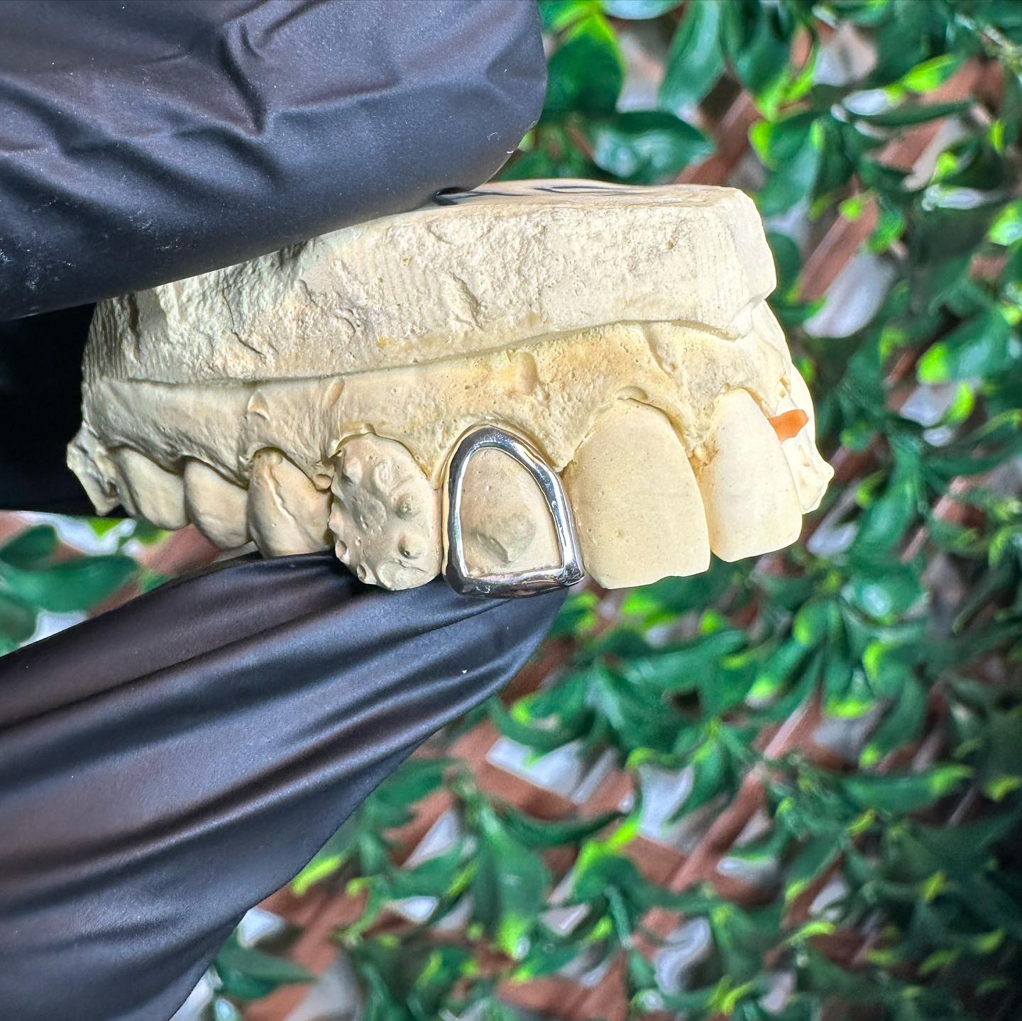 Custom grillz mold detail